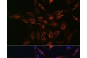 Immunofluorescence analysis of C6 cells using ABCA1 Polyclonal Antibody at dilution of 1:100 (40x lens). (ABCA1 antibody)