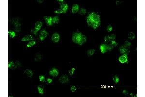 Immunofluorescence of monoclonal antibody to MAPK12 on HeLa cell.