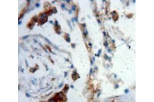 Used in DAB staining on fromalin fixed paraffin-embedded Lung tissue (LTBP2 antibody  (AA 522-814))