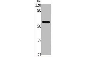 Western Blot analysis of various cells using GCK Polyclonal Antibody (GCK antibody  (N-Term))