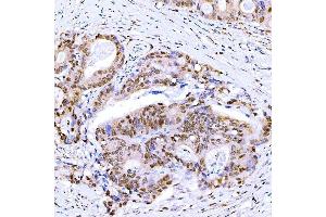 IHC analysis of Symplekin/SYMPK using anti-Symplekin/SYMPK antibody (ABIN7601558). (Symplekin antibody  (AA 384-1092))