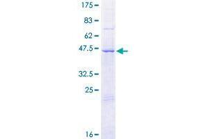DCAKD Protein (AA 1-231) (GST tag)