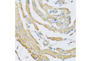 Immunohistochemistry of paraffin-embedded mouse heart using SFRP4 antibody (ABIN5973810) at dilution of 1/100 (40x lens). (SFRP4 antibody)