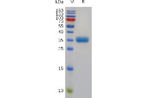 SDS-PAGE (SDS) image for Tryptase alpha/beta 1 (TPSAB1) (AA 19-275) protein (His tag) (ABIN7491010)