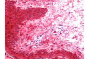 Anti-LGALS7 / Galectin 7 antibody IHC staining of human skin. (LGALS7 antibody  (Biotin))