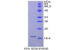 SDS-PAGE analysis of Human Selenoprotein X1 Protein. (MSRB1 Protein)