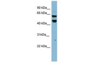 Image no. 1 for anti-Prolyl 4-Hydroxylase, Transmembrane (Endoplasmic Reticulum) (P4HTM) (AA 323-372) antibody (ABIN6741725) (P4HTM antibody  (AA 323-372))