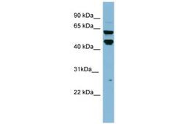 P4HTM Antikörper  (AA 323-372)