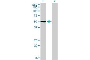 Western Blot analysis of PHGDH expression in transfected 293T cell line by PHGDH monoclonal antibody (M01), clone 4A3-1D6. (PHGDH antibody  (AA 1-533))