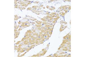 Immunohistochemistry of paraffin-embedded Mouse heart using MAVS antibody (ABIN6132297, ABIN6143583, ABIN6143584 and ABIN6221441) at dilution of 1:100 (40x lens).