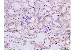 Formalin-fixed and paraffin embedded mouse colon tissue labeled with Anti-TNFSF18 Polyclonal Antibody, Unconjugated (ABIN740535) at 1:200 followed by conjugation to the secondary antibody and DAB staining (TNFSF18 antibody  (AA 101-199))