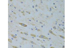 Immunohistochemistry of paraffin-embedded Rat brain using SARS Polyclonal Antibody at dilution of 1:100 (40x lens). (Seryl-tRNA Synthetase (SARS) antibody)