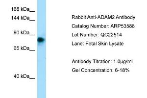 Western Blotting (WB) image for anti-ADAM Metallopeptidase Domain 2 (ADAM2) (N-Term) antibody (ABIN2785462) (ADAM2 antibody  (N-Term))