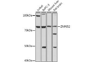 Western blot analysis of extracts of various cell lines, using ZNF652 antibody (ABIN7271517) at 1:1000 dilution. (ZNF652 antibody)
