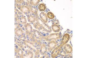 Immunohistochemistry of paraffin-embedded rat kidney using PIP4K2A antibody (ABIN4904769) at dilution of 1:100 (40x lens).