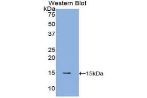 Western Blotting (WB) image for anti-POTE Ankyrin Domain Family, Member J (POTEJ) (AA 109-269) antibody (ABIN1171897) (POTEJ antibody  (AA 109-269))