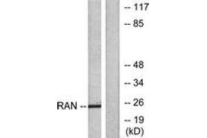 Western blot analysis of extracts from LOVO cells, using RAN Antibody. (RAN antibody  (AA 167-216))