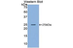 Western Blotting (WB) image for anti-Noggin (NOG) (AA 28-240) antibody (ABIN1175542)