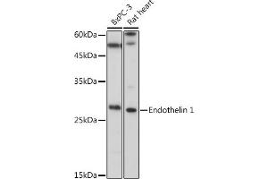 Western blot analysis of extracts of various cell lines, using Endothelin 1 antibody (ABIN3021075, ABIN3021076, ABIN3021077 and ABIN6213940) at 1:1000 dilution. (Endothelin 1 antibody  (AA 18-212))