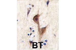 Formalin-fixed and paraffin-embedded human brain tissue reacted with HRH3 polyclonal antibody  , which was peroxidase-conjugated to the secondary antibody, followed by DAB staining. (HRH3 antibody  (C-Term))