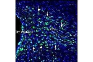 Expression of Glucagon receptor in mouse hypothalamus - Immunohistochemical staining of perfusion-fixed frozen mouse brain sections with Anti-Glucagon Receptor (extracellular) Antibody (ABIN7043218, ABIN7044410 and ABIN7044411), (1:200), followed by goat-anti-rabbit-AlexaFluor-488 secondary antibody. (Glucagon Receptor antibody  (1st Extracellular Loop))