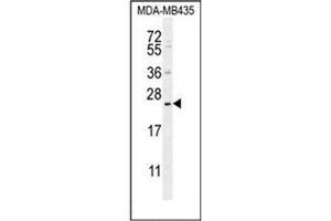 Western blot analysis of FAM109A Antibody (N-term) in MDA-MB435 cell line lysates (35ug/lane). (FAM109A antibody  (N-Term))