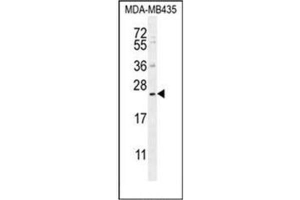 FAM109A antibody  (N-Term)