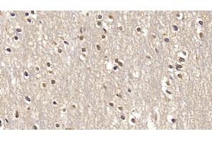 Detection of SMAD3 in Human Cerebrum Tissue using Monoclonal Antibody to SMAD family member 3 (SMAD3) (SMAD3 antibody  (AA 231-425))