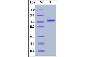 Biotinylated Human IL-2, Fc,Avitag on  under reducing (R) condition.