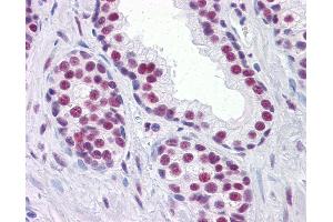 Anti-RUNX2 antibody IHC of human prostate. (RUNX2 antibody  (AA 251-351))