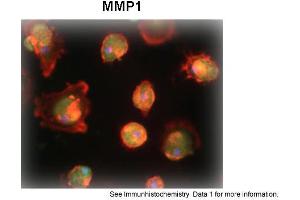 Sample Type: Human Macrophange CellsGreen: primaryRed: phallodinBlue: DAPIYellow: green/redPrimary Dilution: 1:200Secondary Antibody: anti-Rabbit IgG-FITCSecondary Dilution: 1:1000Image Submitted By: Milan FialaUniversity of California, Los Angeles (MMP1 antibody  (N-Term))