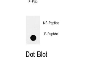 Dot Blot (DB) image for anti-Insulin Receptor Substrate 2 (IRS2) (pTyr978) antibody (ABIN3001883) (IRS2 antibody  (pTyr978))