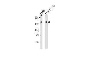 Western blot analysis of lysates from Hela cell line and human placenta tissue lysate(from left to right), using COL4A1 Antibody (N-term) A. (COL4A1 antibody  (N-Term))