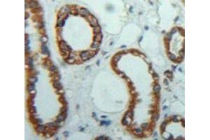 #VALUE! (FLNC antibody  (AA 2519-2725))