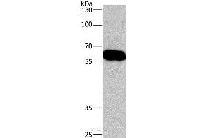 Western blot analysis of Lovo cell , using CORO1C Polyclonal Antibody at dilution of 1:670 (CORO1C antibody)