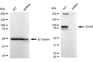 Western blotting analysis using CD105 antibody (ABIN7798440).