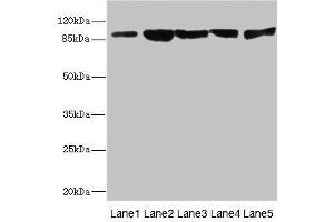 Western blot All lanes: DSC2 antibody at 3.