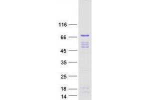 Validation with Western Blot (WHSC2 Protein (Myc-DYKDDDDK Tag))
