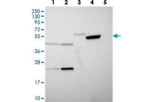Western blot analysis of Lane 1: RT-4, Lane 2: U-251 MG, Lane 3: Human Plasma, Lane 4: Liver, Lane 5: Tonsil with TIGD6 polyclonal antibody  at 1:250-1:500 dilution. (TIGD6 antibody)