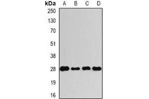 Western blot analysis of VENTX expression in A549 (A), HepG2 (B), mouse spinal cord (C), rat bone marrow (D) whole cell lysates. (VENTX antibody)