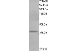ABIN184711 staining (1µg/ml) of Jurkat lysate (RIPA buffer, 35µg total protein per lane). (CYTIP antibody  (N-Term))