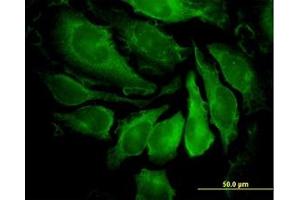 Image no. 4 for anti-P21-Activated Kinase 1 (PAK1) (AA 191-280) antibody (ABIN598852) (PAK1 antibody  (AA 191-280))