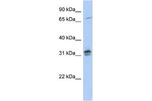 WB Suggested Anti-H1FOO Antibody Titration: 0. (H1FOO antibody  (N-Term))