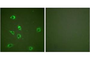 Immunofluorescence analysis of NIH/3T3 cells, using Glucagon antibody (ABIN5976409). (Glucagon antibody  (Internal Region))