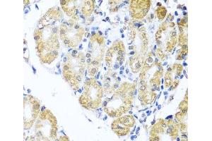 Immunohistochemistry of paraffin-embedded Human stomach using BNIP3L Polyclonal Antibody at dilution of 1:100 (40x lens). (BNIP3L/NIX antibody)