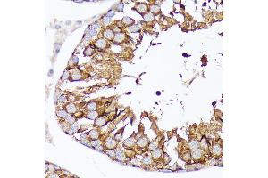 Immunohistochemistry of paraffin-embedded rat testis using Nectin 2/CD112 Rabbit mAb (ABIN7269432) at dilution of 1:100 (40x lens). (PVRL2 antibody)