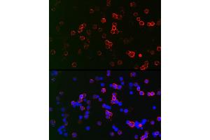 Immunofluorescence analysis of Raji cells using CD22 Rabbit pAb (ABIN6131253, ABIN6138143, ABIN6138144 and ABIN6221471) at dilution of 1:150 (40x lens). (CD22 antibody  (AA 708-847))