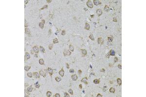 Immunohistochemistry of paraffin-embedded mouse brain using TRPC3 antibody (ABIN5995383) (40x lens).