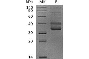 Western Blotting (WB) image for CD3 epsilon (CD3E) (Active) protein (mFc Tag) (ABIN7319783) (CD3 epsilon Protein (CD3E) (mFc Tag))