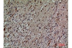 Immunohistochemical analysis of paraffin-embedded human-brain, antibody was diluted at 1:100. (CD58 antibody  (Internal Region))